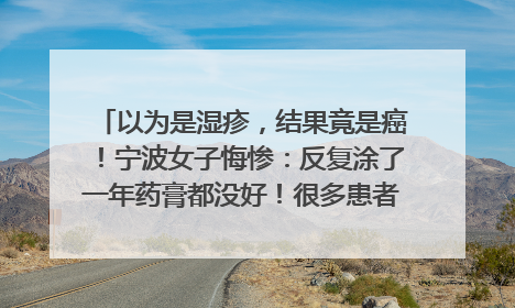 以为是湿疹，结果竟是癌！宁波女子悔惨：反复涂了一年药膏都没好！很多患者首诊都去了皮肤科