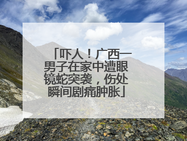 吓人！广西一男子在家中遭眼镜蛇突袭，伤处瞬间剧痛肿胀